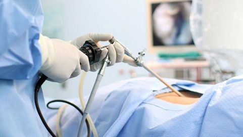 Different Types & Uses of Endoscopy Equipment